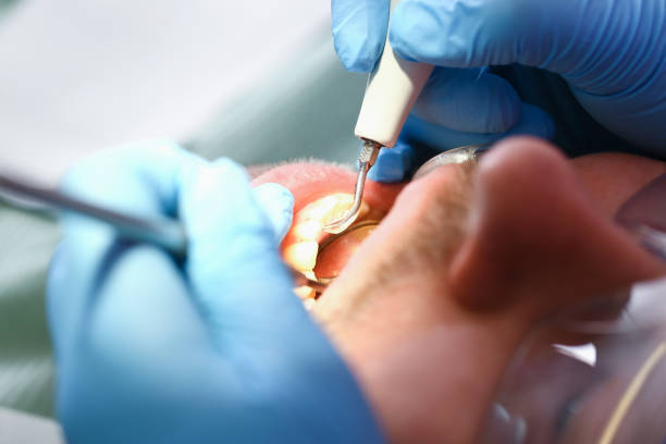 Best Pediatric Emergency Dentist in East Williston, NY